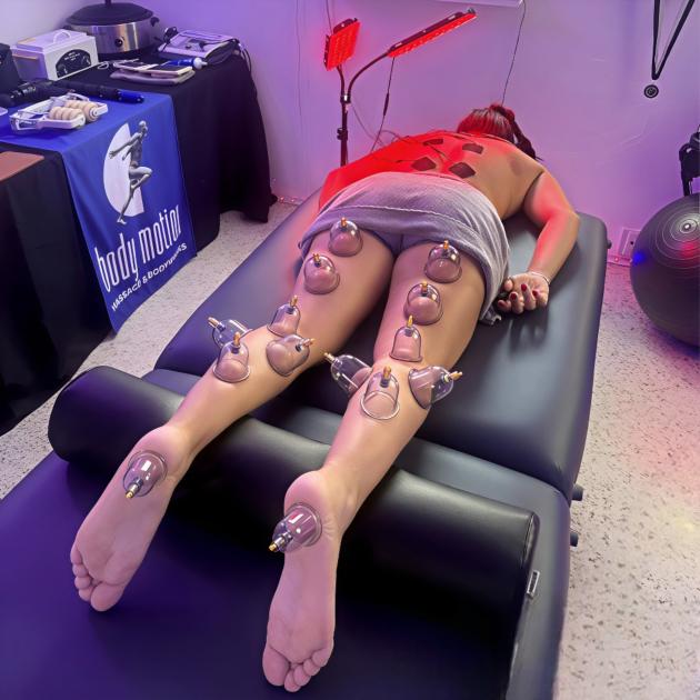 Cupping Therapy